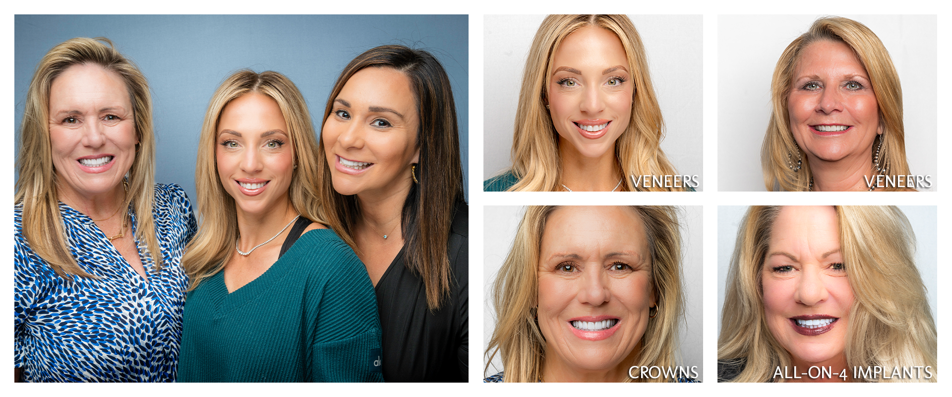 Complete Smile Makeover