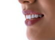 Top Tips for a Brighter Smile With Teeth Whitening